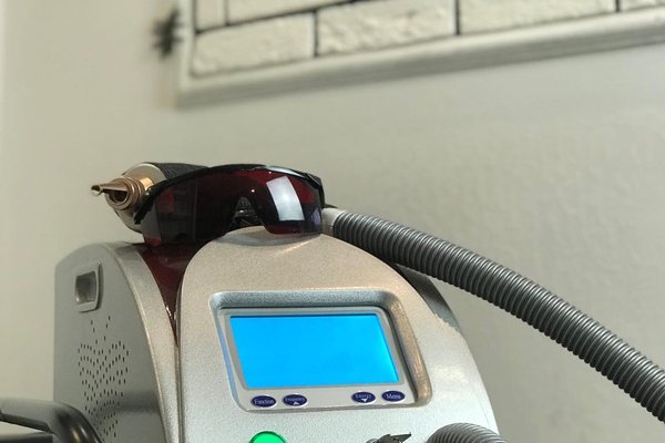 Laser PMU removal in Košice