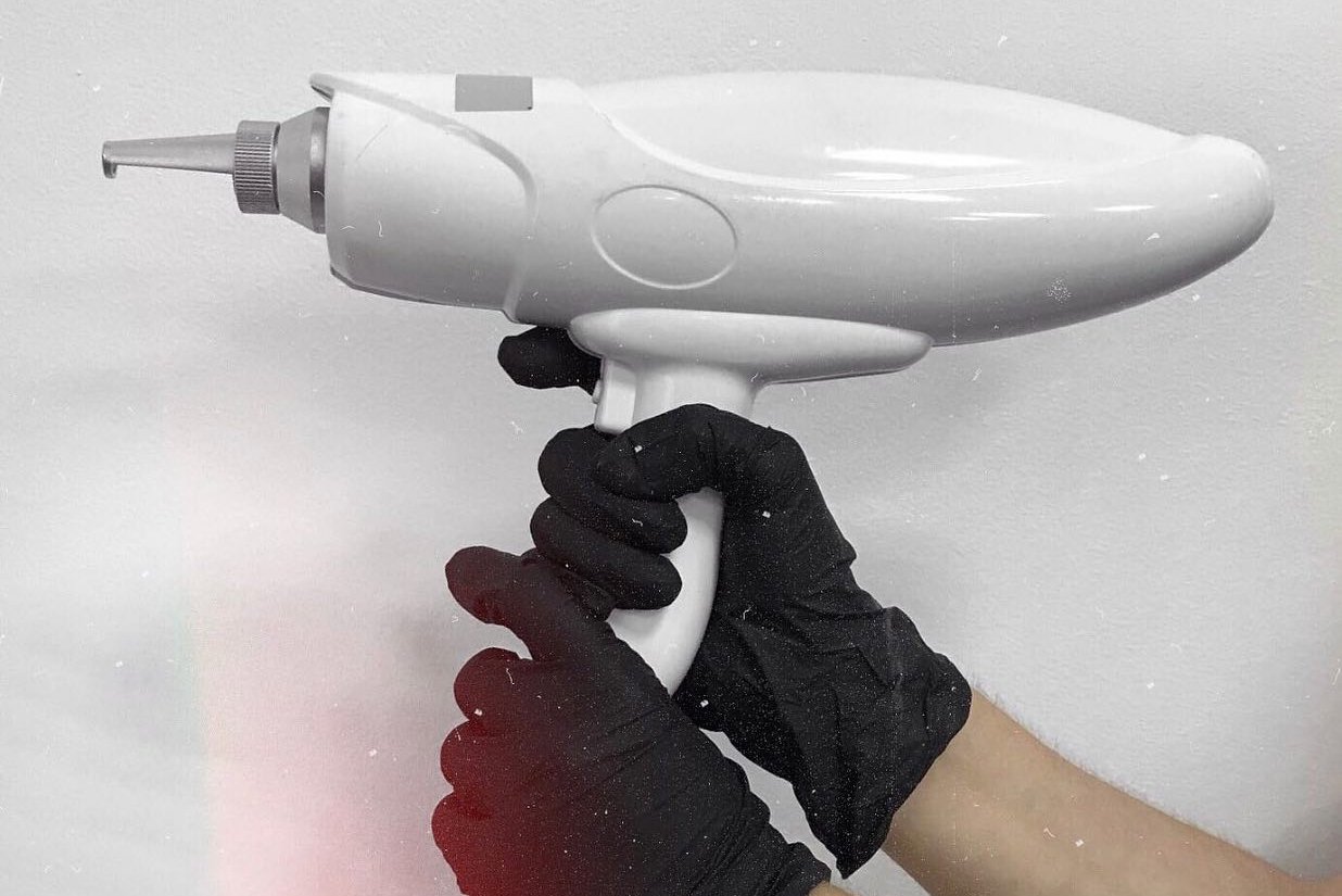 Laser PMU removal in Košice