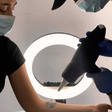 Laser tattoo removal in Košice