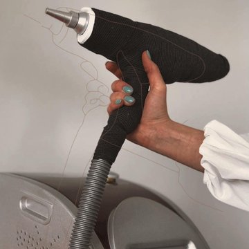 Laser PMU removal in Košice