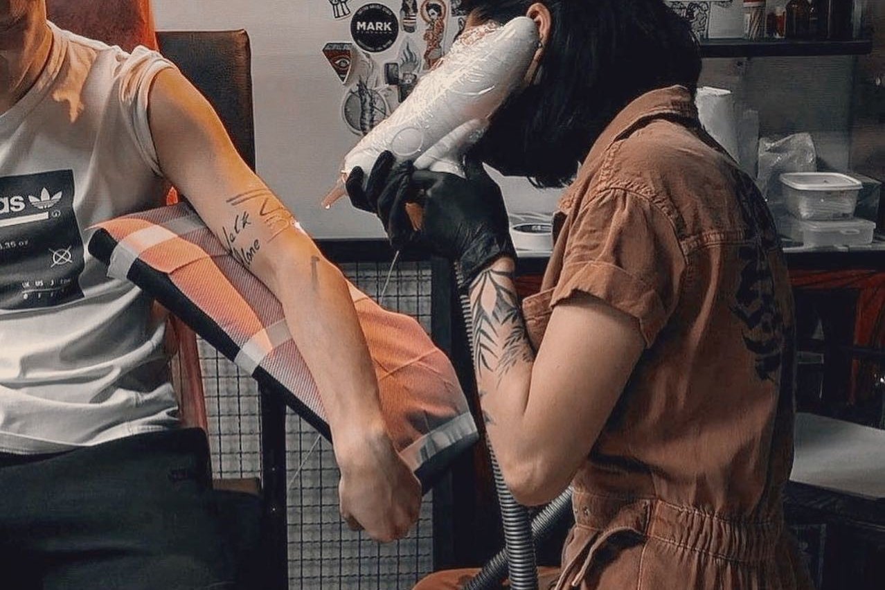 Laser tattoo removal in Košice